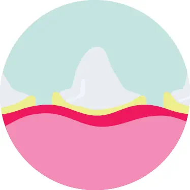 Dog dental tooth and gum care Sutton
