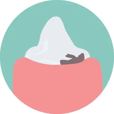 Feline odontoclastic resorptive lesions, cat dental care
